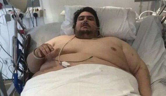 Ky është njeriu më i shëndoshë në botë, peshon 298 kg dhe pi veç pije të gazuara