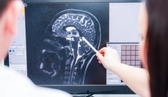 Imazhi i papritur i një truri që po vdiste, zbulohet çka 'pa' pacienti para vdekjes së tij