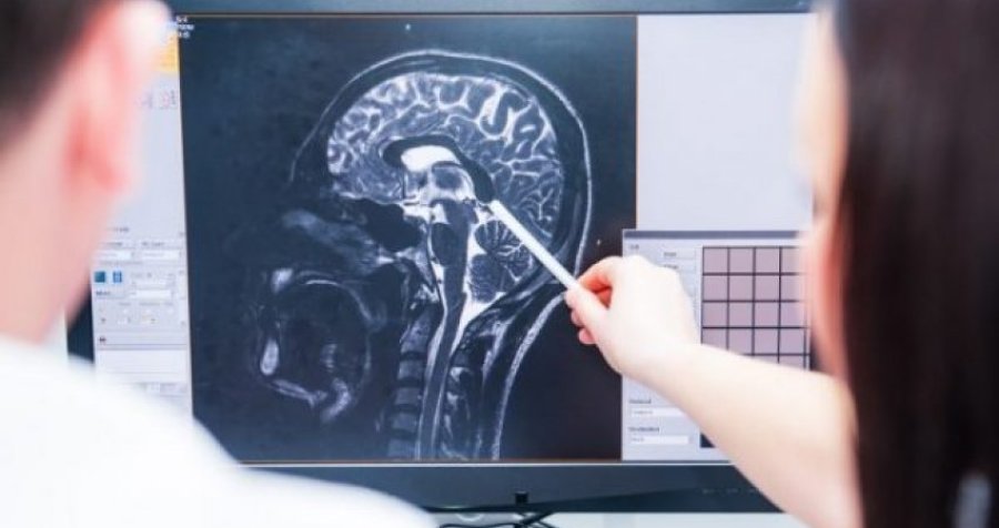 Imazhi i papritur i një truri që po vdiste, zbulohet çka 'pa' pacienti para vdekjes së tij