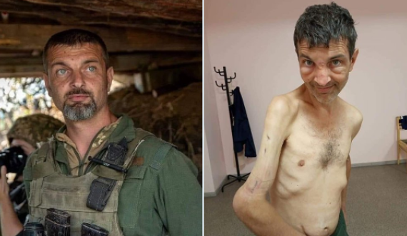 Ukraina publikon imazhet tronditëse të ushtarit që u kap rob nga Rusia