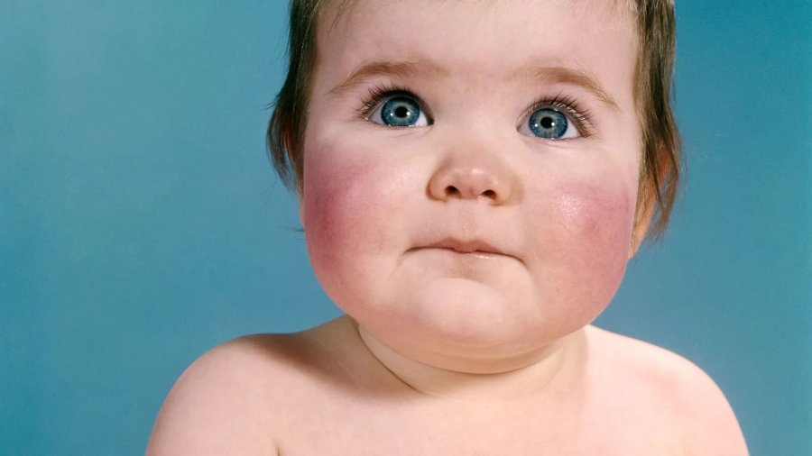 A e dini pse ndryshon ajo ngjyra e syve me të cilën lindin bebet? Por kjo nuk ndodh me të gjithë. Ja si shpjegohet