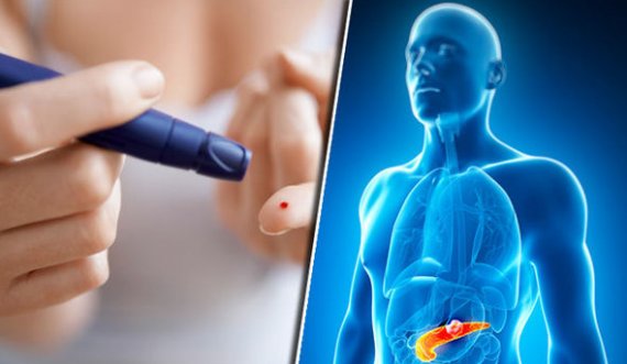 Pankreasi artificial pompon më mirë në menaxhimin e diabetit, tipi 1