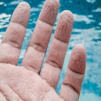 A e dini përse rrudhet lëkura në majat e gishtave kur qëndrojmë gjatë në ujë?