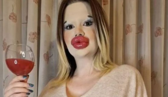 A është kjo vajza me buzët më të mëdha në botë?