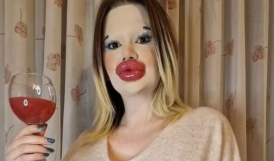 A është kjo vajza me buzët më të mëdha në botë?