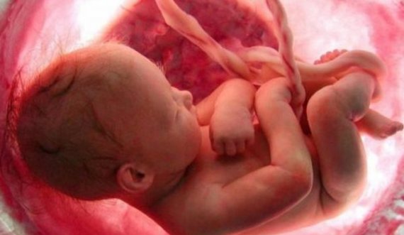 Rast i rradhë që ndodh një në 80,000 lindje, foshnja lind “me këmishë”