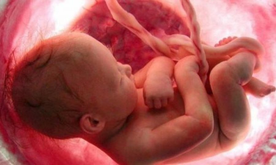 Rast i rradhë që ndodh një në 80,000 lindje, foshnja lind “me këmishë”