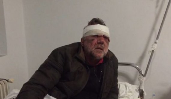 “Profesor eja të qeras me një kafe”, mësuesi bëhet për spital