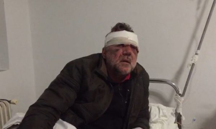 “Profesor eja të qeras me një kafe”, mësuesi bëhet për spital