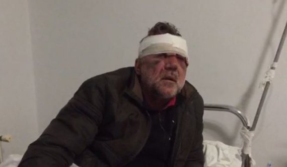 “Më ngacmoi s*ksualisht motrën”, arrestohet i riu që dhunoi mësuesin, policia ndalon edhe 59-vjeçarin