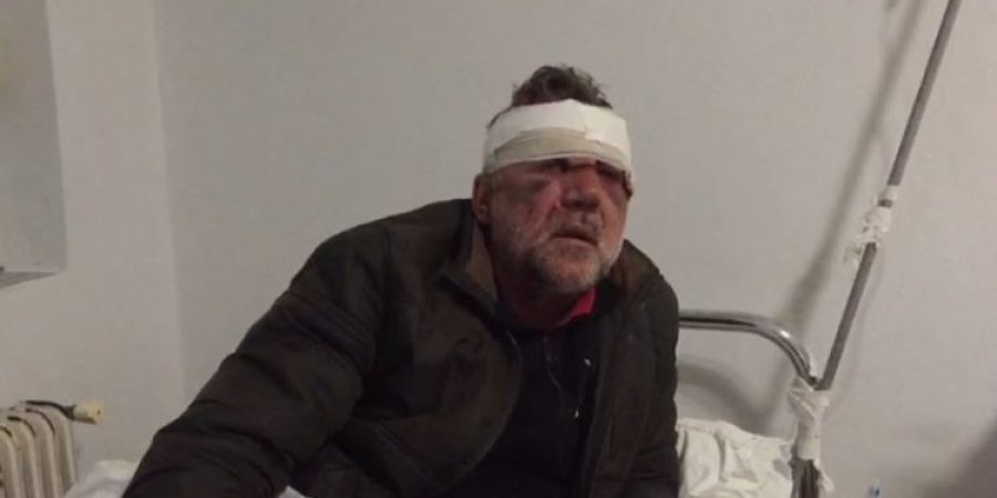 “Më ngacmoi s*ksualisht motrën”, arrestohet i riu që dhunoi mësuesin, policia ndalon edhe 59-vjeçarin