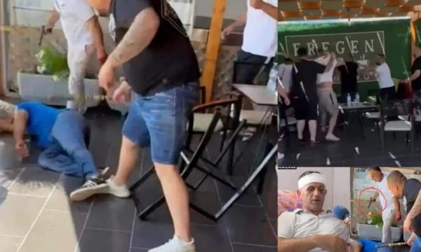 Djali i deputetit dhe dy vëllezërit e tij si gangster një rrahje të tmerrshme me shkopinj në krah 