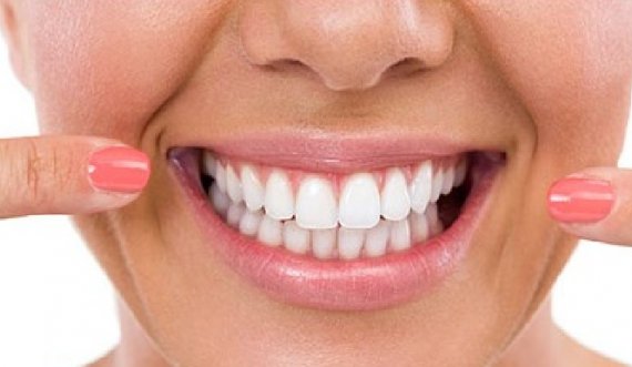 Për buzëqeshje të bardhë: Ja si të hiqni gurët nga dhëmbët