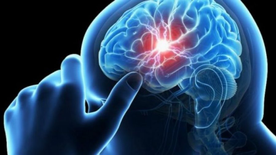 Çfarë e parandalon sulmin në tru?