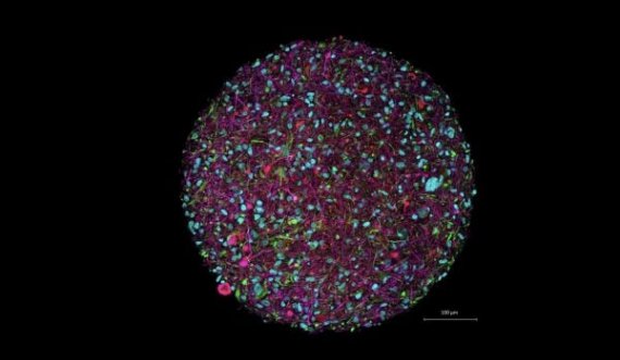 Biokompjuterët e ndërtuar me neurone njerëzore
