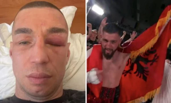 Boksieri serb rrahet brutalisht nga shqiptari Bernardin Jakaj,  shfaqet fytyrën e ënjtur dhe syrin e mbyllur 