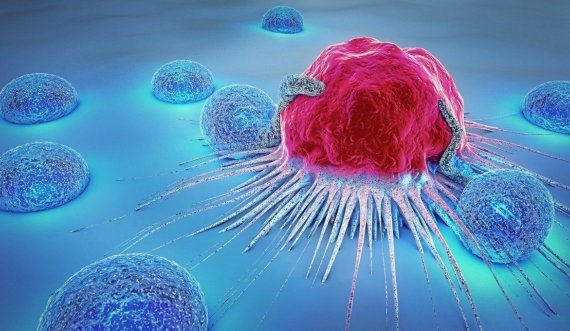 Onkologët këshillojnë: Shmangeni kancerin duke mos i përdorur këto ushqime