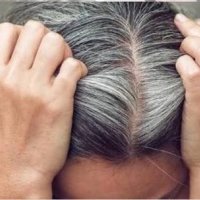 Njerëzit e thinjur janë më të mbrojtur nga melanoma