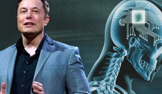Elon Musk merr aprovimin, do testojë çipat në trurin e njerëzve! Synon të ndihmojë njerëzit me aftësi të kufizuar