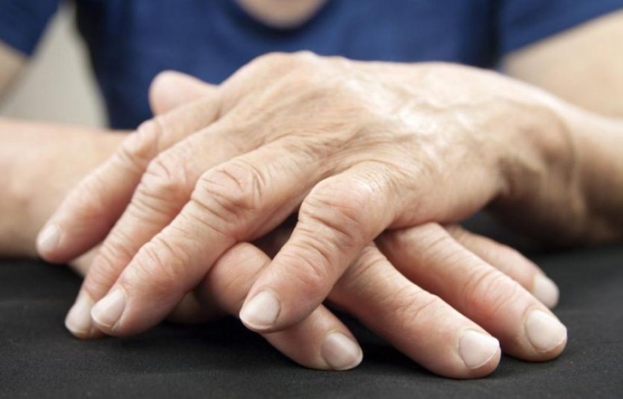 Kjo simptomë në duar mund të sinjalizojë gjendje serioze