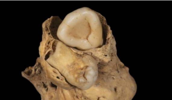 Gjetja e rrallë në trupin e një gruaje të lashtë egjiptiane