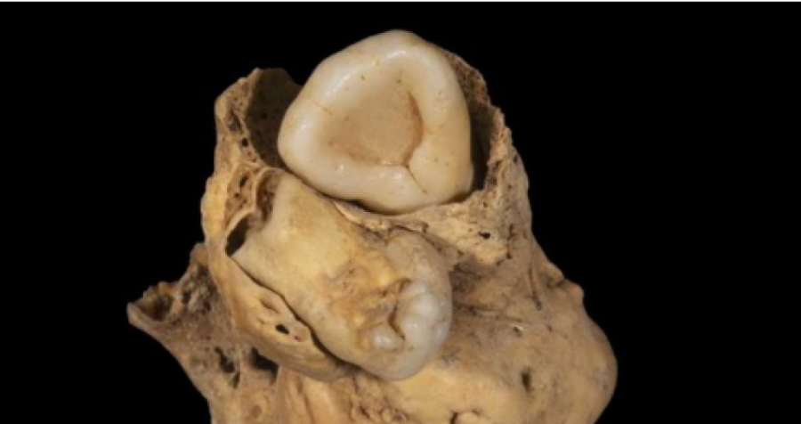 Gjetja e rrallë në trupin e një gruaje të lashtë egjiptiane