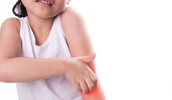 A vuajnë fëmijët tuaj nga alergjitë? Fajin mund ta ketë pastruesi i enëve