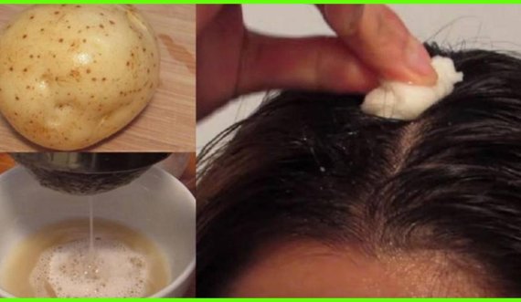Si ta përdorni lëngun e patates për rritjen e flokëve