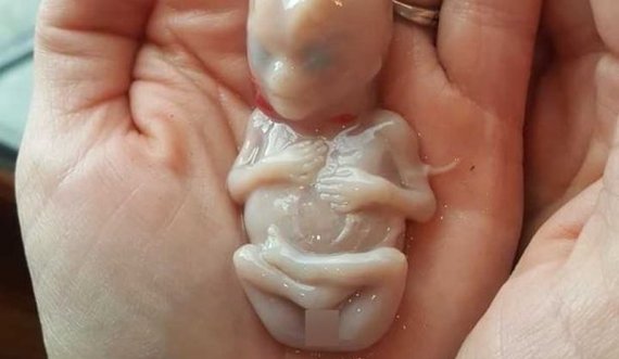 Shokuese/ Gjendet fetusi i ngrirë në frigorifer në banesën e çiftit, si u zbulua ngjarja m*kabre