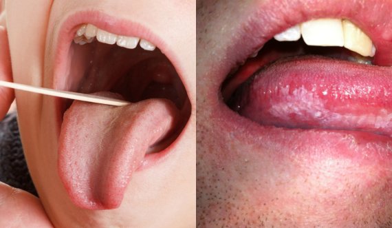 Si të hiqni qafe aromën e pakëndshme nga goja