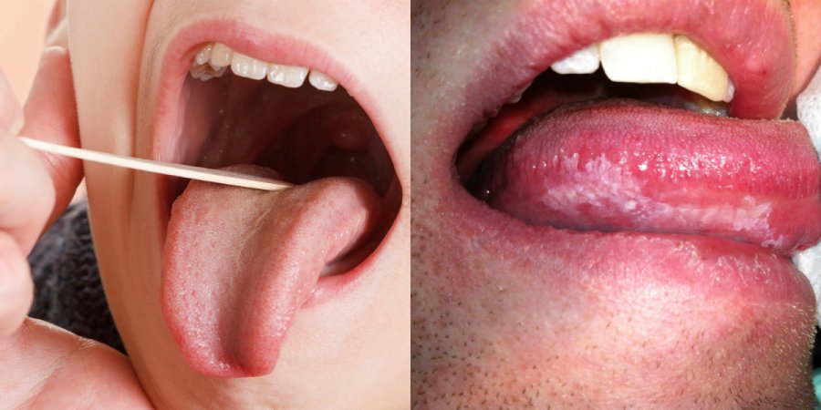 Si të hiqni qafe aromën e pakëndshme nga goja