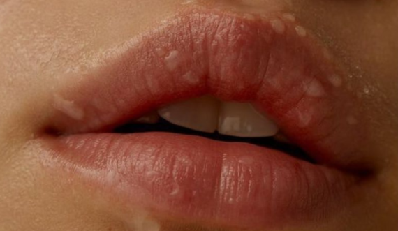 Sekreti për buzë të plota dhe të hidratuara është më i thjeshtë seç e ke menduar
