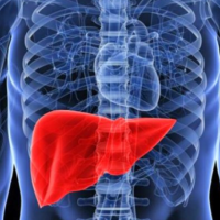 Sëmundja e heshtur që po prek miliona njerëz