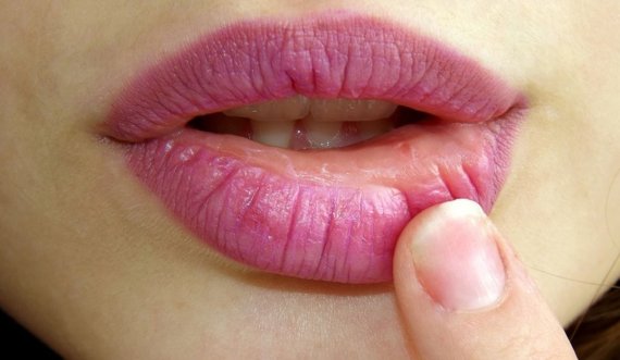 Çfarë thonë për shëndetin buzët tuaja?