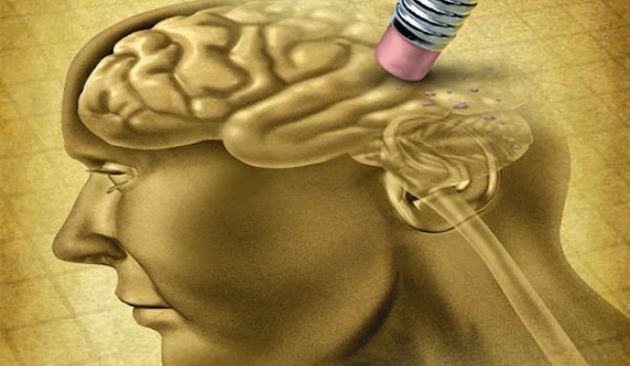 Mungesa e vitaminave D shton rrezikun për demencën