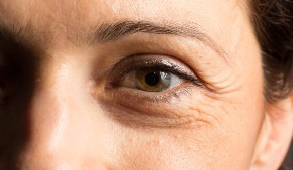 Zbulohen mikroorganizmat përgjegjës për rrudhat e fytyrës