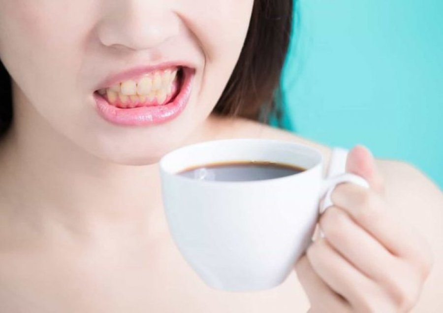 Simptoma në gjuhën tuaj e cila po ju sinjalizon se nuk duhet të pini kafe…