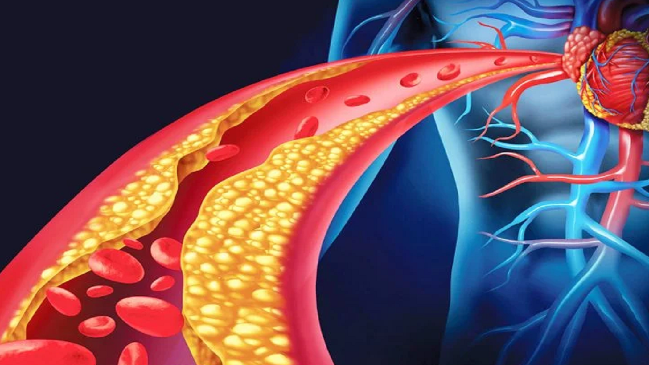 Kolesteroli i lartë, por edhe mungesa e tij, janë të dëmshëm
