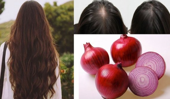 Lëngu i qepës stimulon rritjen e flokëve