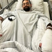 35 vjeçari pësoi infeksion gjatë pushimeve, humbi të dy këmbët dhe gishtat e dorës