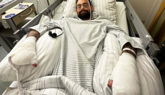 35 vjeçari pësoi infeksion gjatë pushimeve, humbi të dy këmbët dhe gishtat e dorës