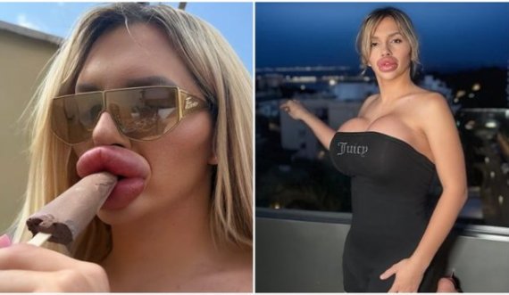 Modelja flet pas ndërhyrjeve plastike: Kam probleme me frymëmarrjen, por për bukurinë ia vlen!