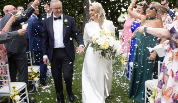 Martohet Anthony Albanese