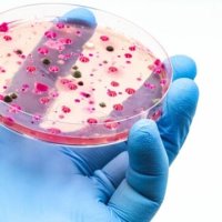 Kërpudha vdekjeprurëse po përhapet globalisht dhe po bëhet më infektuese