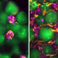 'Mëlçitë satelite' të injektueshme mund të ofrojnë një alternativë