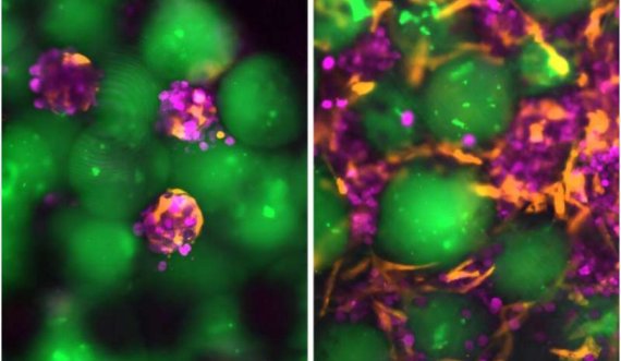 'Mëlçitë satelite' të injektueshme mund të ofrojnë një alternativë