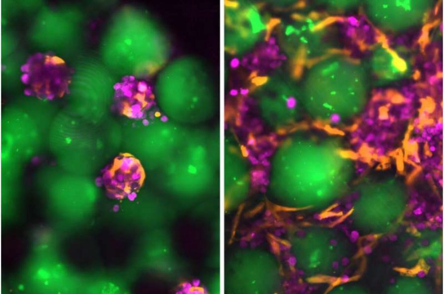'Mëlçitë satelite' të injektueshme mund të ofrojnë një alternativë