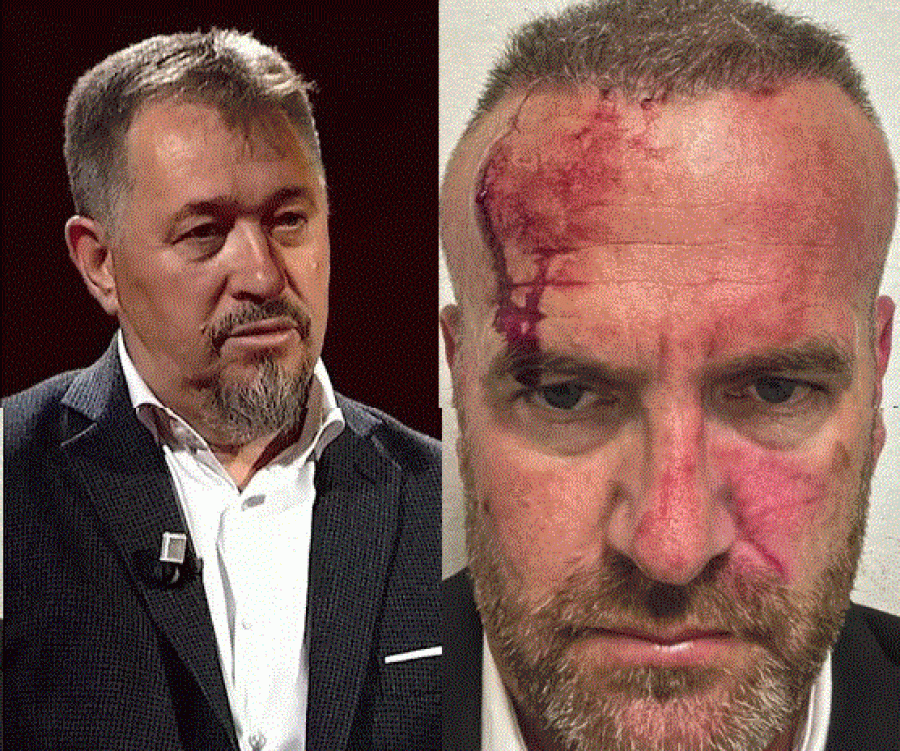 Flet Hysni Mehani: Sami Lushtaku më goditi me telefon